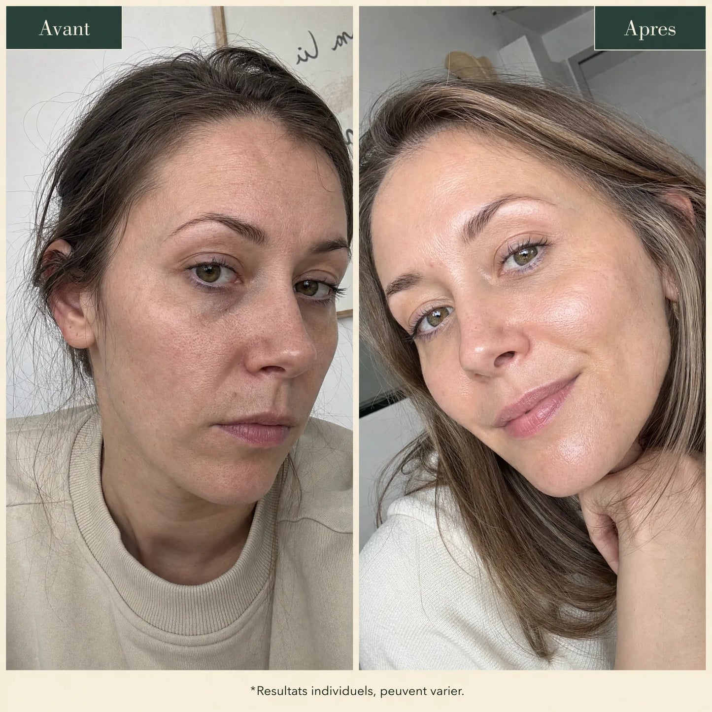 Avant / après Skin Reset : grain lissé, pores affinés, teint plus éclatant