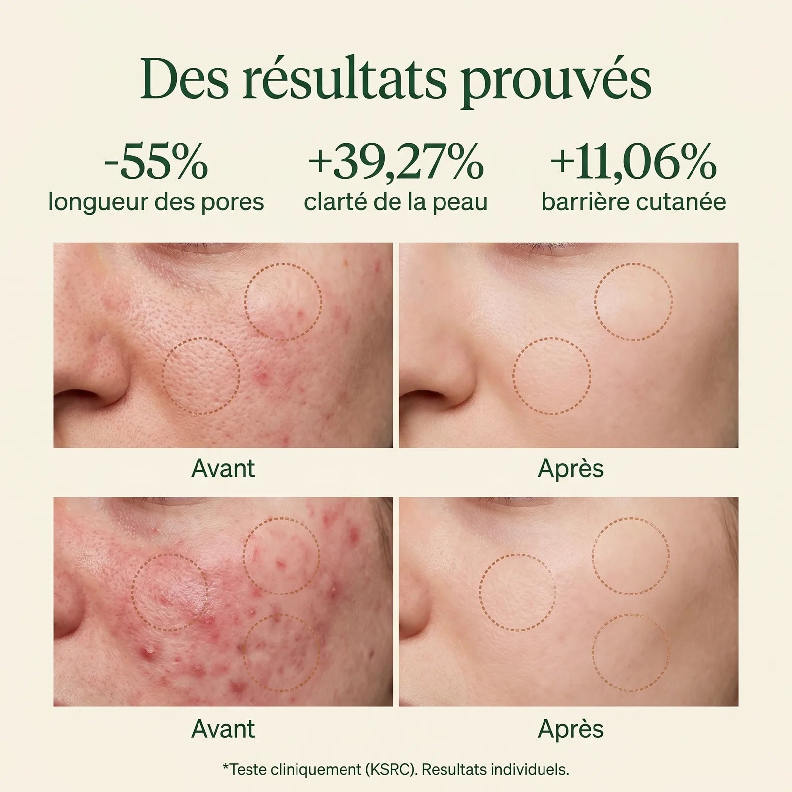 Résultats cliniques Skin Reset : -55% longueur des pores, +39% clarté, +11% barrière cutanée
