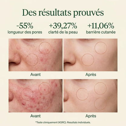 Résultats cliniques Skin Reset : -55% longueur des pores, +39% clarté, +11% barrière cutanée