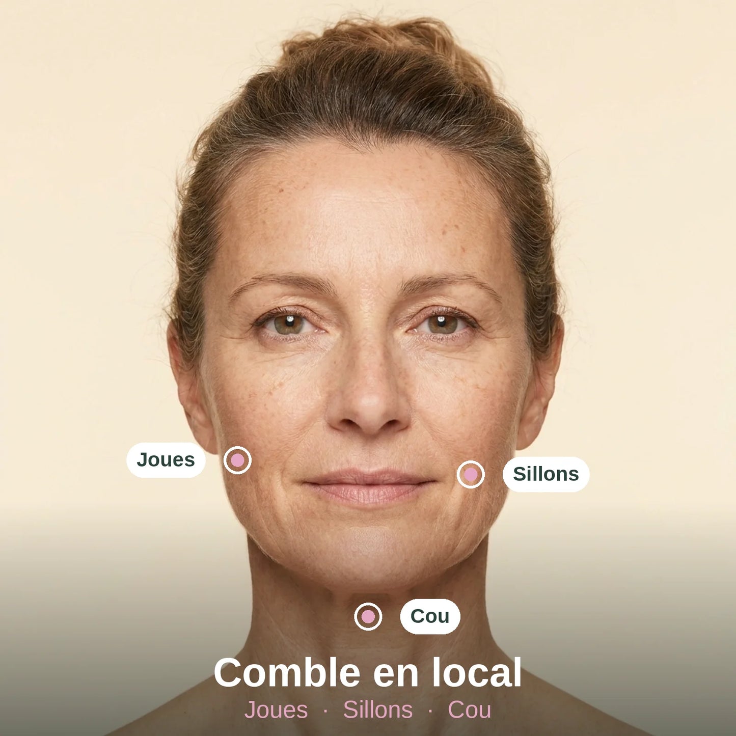 Les trois zones ciblées par Volume Reset : joues, sillons, cou