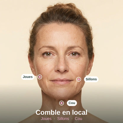 Les trois zones ciblées par Volume Reset : joues, sillons, cou